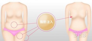 怎样丰胸最快最有效？丰胸秘方让你越来越迷人！