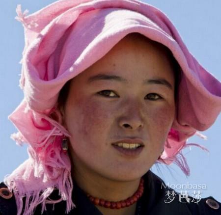 脸上的红血丝怎么消除